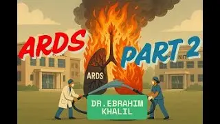 ARDS PART 2 - Management
