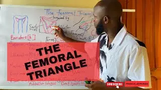 Femoral Triangle made simple
