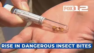 Doctors see more patients with insect bites in Oregon, warn against risk of disease from insects