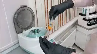 PRP-терапия T-LAB