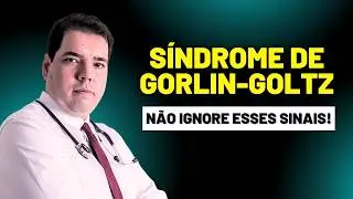 S&iacute;ndrome de Gorlin Goltz - S&iacute;ndrome do Carcinoma Basocelular