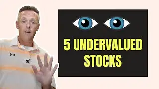 5 Undervalued Stocks to Watch in August 2021