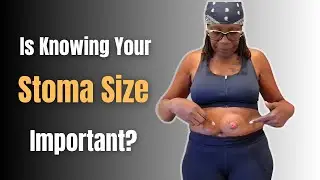 How I Measure My Stoma: Why Size Changes Matter