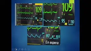 MONITOREO DEL PACIENTE EN ANESTESIA