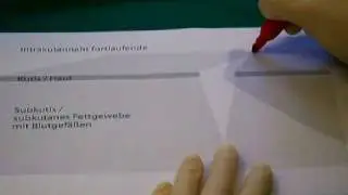 Theorie Intrakutannaht fortlaufend