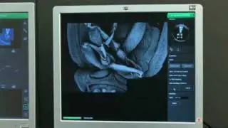 Phenom World Phenom Pro Suite Software