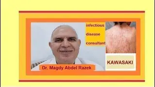 KAWASAKI DISEASE IN CHILDREN podcast