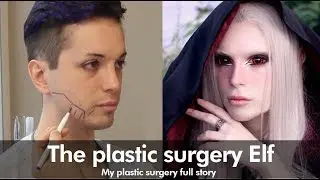 I&rsquo;ve Spent $60,000 Turning Into An Elf | My plastic surgery story in korea