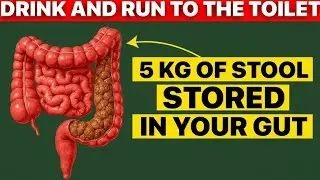 Flush 5 KG in 1 Hour! Say Goodbye to Constipation & Bloating!