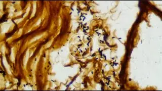 Helicobacter pylori under the microscope with Warthin&ndash;Starry stain