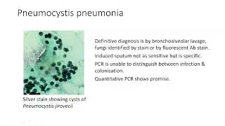 Approach to Respiratory Opportunistic Infections in Patients with HIV - Gary Maartens