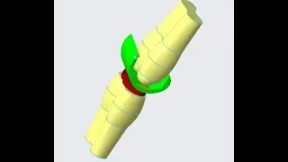 3d CAD Design of Total Knee Replacement by Solidworks in Computational Biomechanics Biomedical