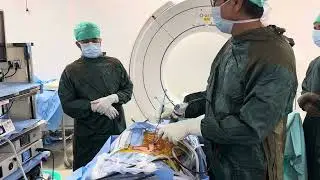 Endoscopic spine surgery using Neuro navigation : Precision accuracy safety small cut fast recovery