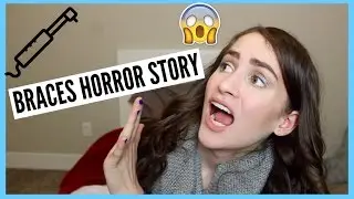 BRACES HORROR STORY // My REAL Braces Experience ♡