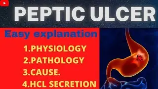 PepticUlcer in hindi | PepticUlcer | PepticUlcer Pathophysiology |