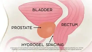 How Does SpaceOAR Work?