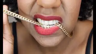 NEW SMILE REVEAL! VENEERS/ADULT BRACES JOURNEY