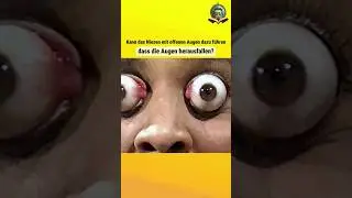 Kann das Niesen mit offenen Augen dazu f&uuml;hren, dass die Augen herausfallen?