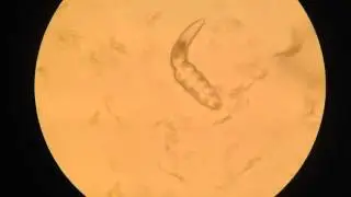 Демодекоз у собак (Demodex Canis). Видео.