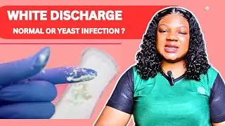 Vaginal Yeast Infection Treatment &ndash; Causes, Symptoms & Natural Prevention Tips