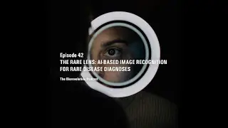 The Rare Lens: AI-based image recognition for rare disease diagnoses