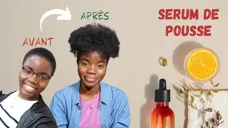 DIY SERUM POUSSE DE CHEVEUX