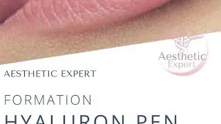 Aesthetic expert