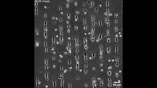Reategui Lab Video 3 - High-density U-87 MG cells migrating on migrasome-mimetic trails