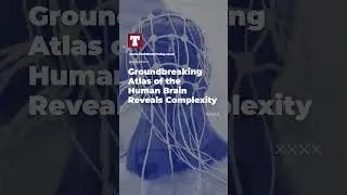 Groundbreaking Atlas of the Human Brain Reveals Complexity #Science #shorts #News #technews