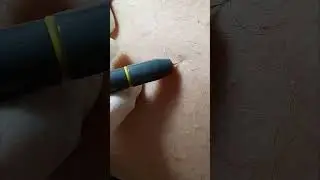 İğneli Epilasyon Bacak bölgesi (Electrolysis Epilation)