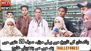 | Dr.Rana Muhammad Sarwar ||19 Gallstones Patients cure without surgery || By Homeopathy Medicines |