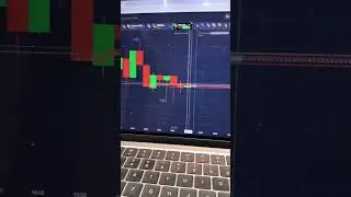 Binary Options Trading | Binary Options Trading | Quotex Trading Strategy #sureshot #shorts