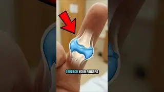 What Really Happens When Knuckles Crack 😲