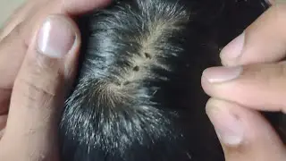 500$ High pressure head massage ASMR Relaxing and sleeping part 49 😴😪