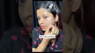 Hibiscus 🌺 flower with Honey 🍯 Naturally Face Pack#shortvideo #brightskin #whitning #facepacke #diy