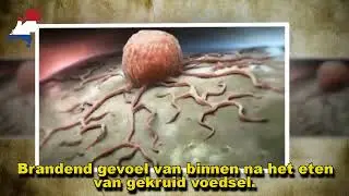 Darmpolypen de feiten
