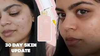 WISHFUL GET EVEN ROSE OIL 30 DAY SKIN UPDATE | ADITIMAKEUP