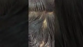 Piojos caso súper severo