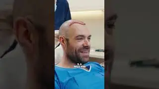 A 37 ans, il a dit STOP &agrave; la calvitie : sa greffe de cheveux en images