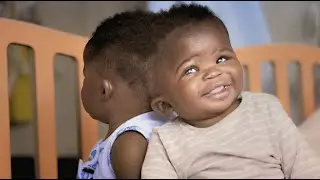 Two conjoined twins separated successfully in Italy