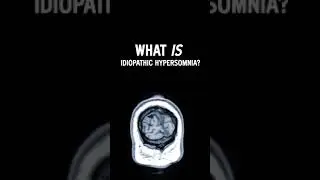 What is idiopathic hypersomnia?