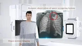 Ceiling mounted Dynamic DR system