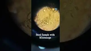 What is a identify this stool sample # Stool Test# Stool under microscope