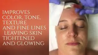 Illume Vampire Facial