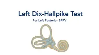 At Home Left Dix-Hallpike Test for BPPV Vertigo