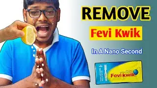 Feviquick Remover From Hand | How To Remove Feviquick From Hand