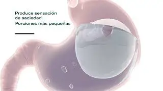 Programa Allurion: para una vida m&aacute;s saludable