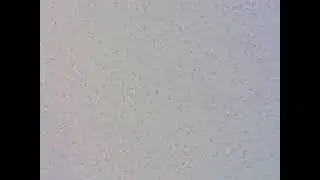 Suspected Chromobacterium violaceum Underneath Phase-Contrast Microscope