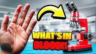 Infected Blood Under Microscope |   #science#microbiology #microscope
