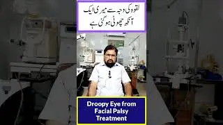 Droopy Eye from Facial Palsy Treatment  | Falij / Laqwa se ankh choti hona